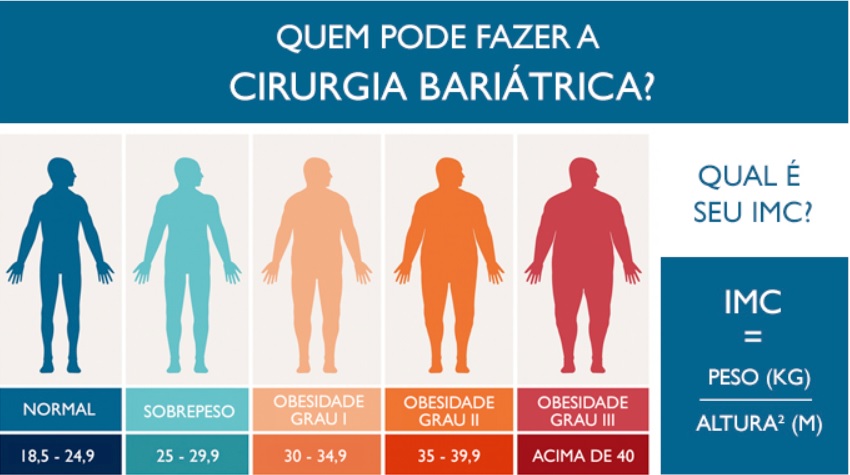 Cirurgia bariátrica, quem pode fazer?